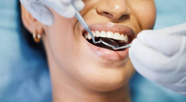 Best Emergency Dental Care for Broken or Chipped Teeth in Sale Creek, TN